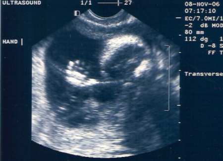 Our Baby,  taken Nov 8, 2006