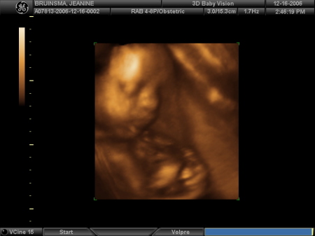 Dawson at 29 weeks