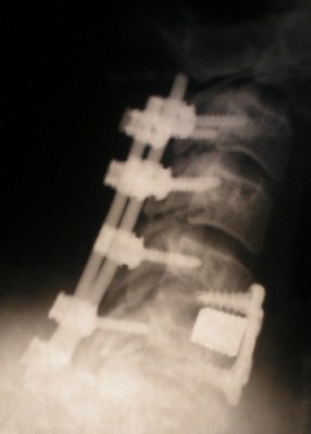 x-ray of neck-side view