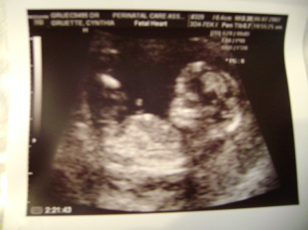 Baby ultrasound!!