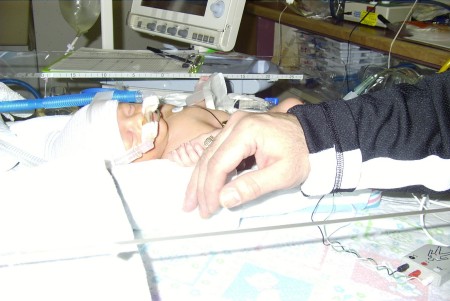 Mason- the little fighter with dad's hand