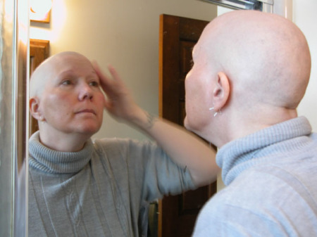 May, bald, during chemo for breast cancer in 2004