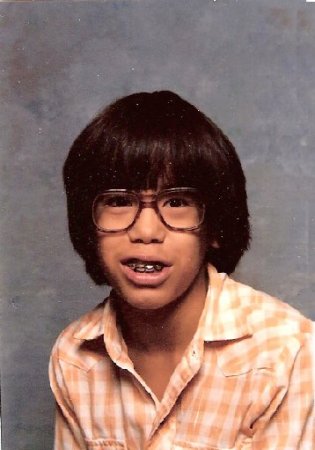 The Great Glasses and Braces Photo