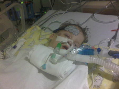 christian after 3rd open heart surgery