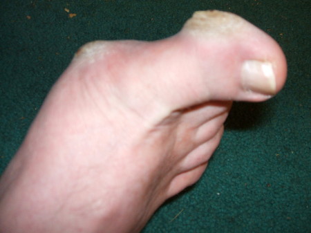 My foot, after walking waaay too far