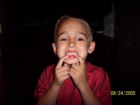 lost his first tooth