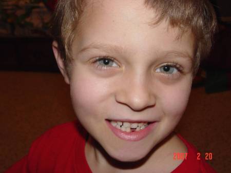 Cameron lost his first tooth