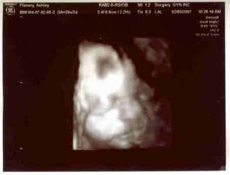 My new Grandaughter's Ultrasound/Ashley should deliver any day