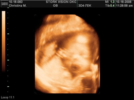 Brynner will be here in January!