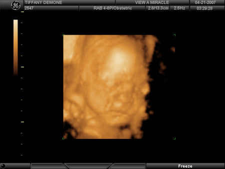 3-D ultrsound of Tiff's baby boy