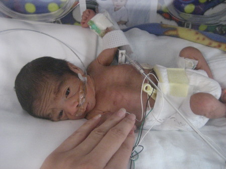 Thomas in the NICU