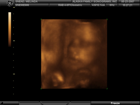 3D Sonograms Pictures of Xander!!!