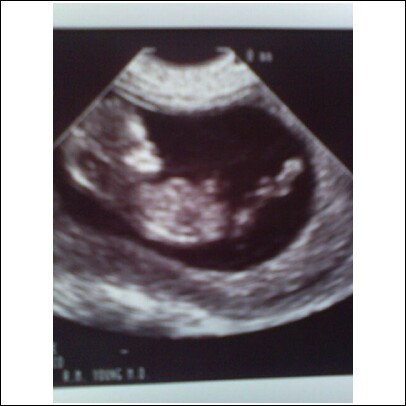 My unborn Grandson!