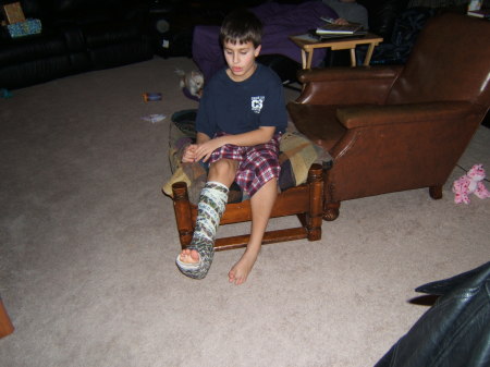 Cole in his cast