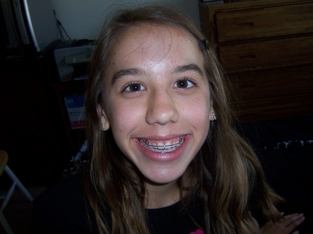 sierra's braces off 002