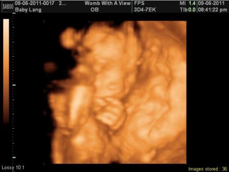 My Grandson due on January 21, 2012