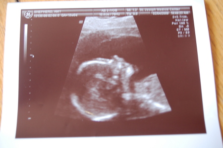 our baby girl due July 09