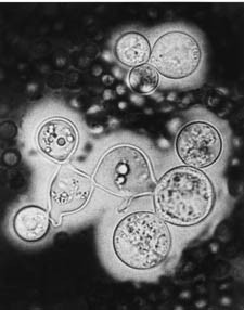 Cryptococcus