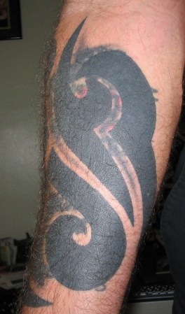 bottom of right forearm