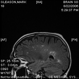 First MRI image
