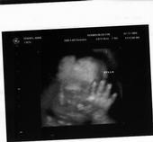 new grandbaby waving hello from the womb