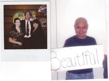 2006 Breast Cancer, Hair by Chemo