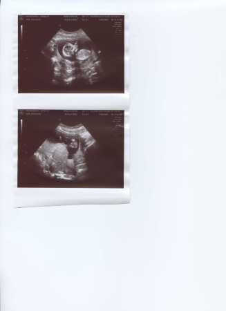Our Baby Boy Due in May