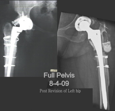 X-rays of 2009