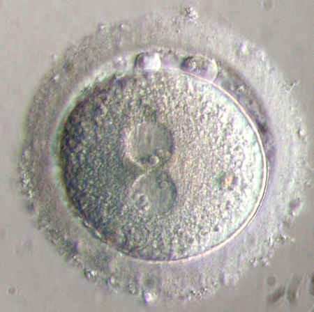 zygote