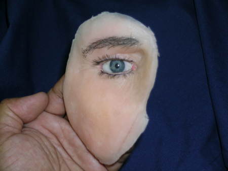 Ocularfacial Prostheses