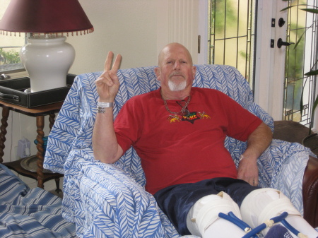 After knee replacement surgery, 2/2010