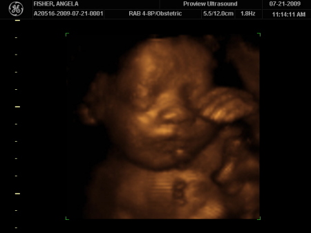Braxtin's 3D Ultrasound - 28 weeks gestation