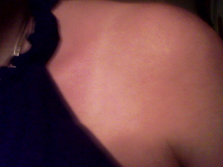 MY SHOULDER