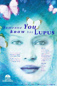 I have Lupus....