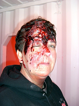 Head wound