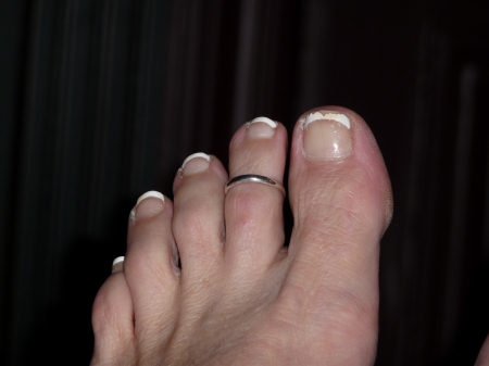 foot with ring