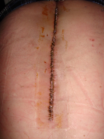 over 250 staples