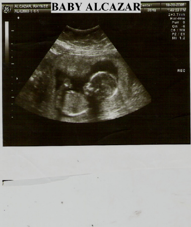 OUR NEW BUNDLE OF JOY DUE IN FEB. I CAN'T WAIT TO SEE HIM.
