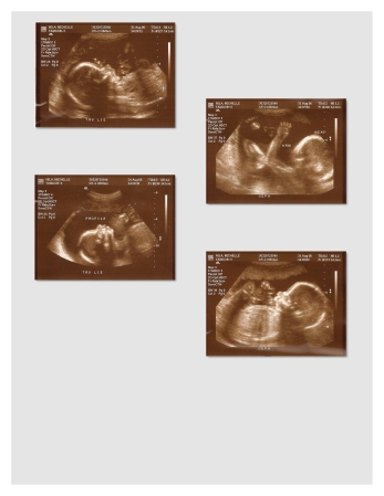More Ultrasounds.