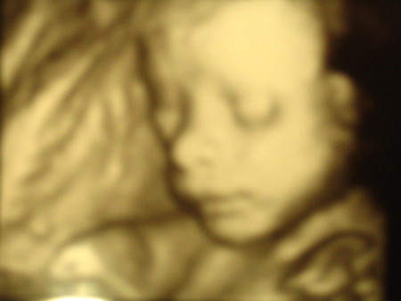 My baby at 24 weeks