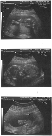 Our baby!! (due in May)