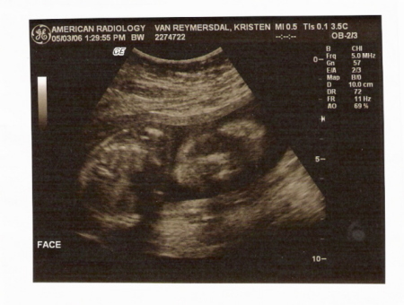 My little man at 20 weeks.