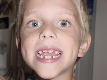 Toothless Thomas