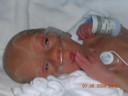 Cody at one day old