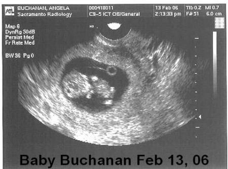 Baby at 9wks