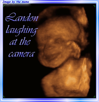 Landon's 25 week U/S Photo