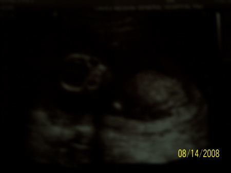 ~ our Baby Girl :)   ~