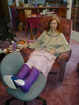 Susan's purple casts July 5 2001