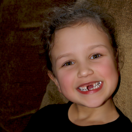 Our Toothless Wonder!