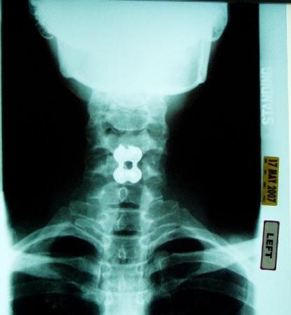 my x-rays 2